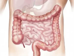Jenis Kanker Paling Banyak Menyerang Anak Muda Menurut Studi